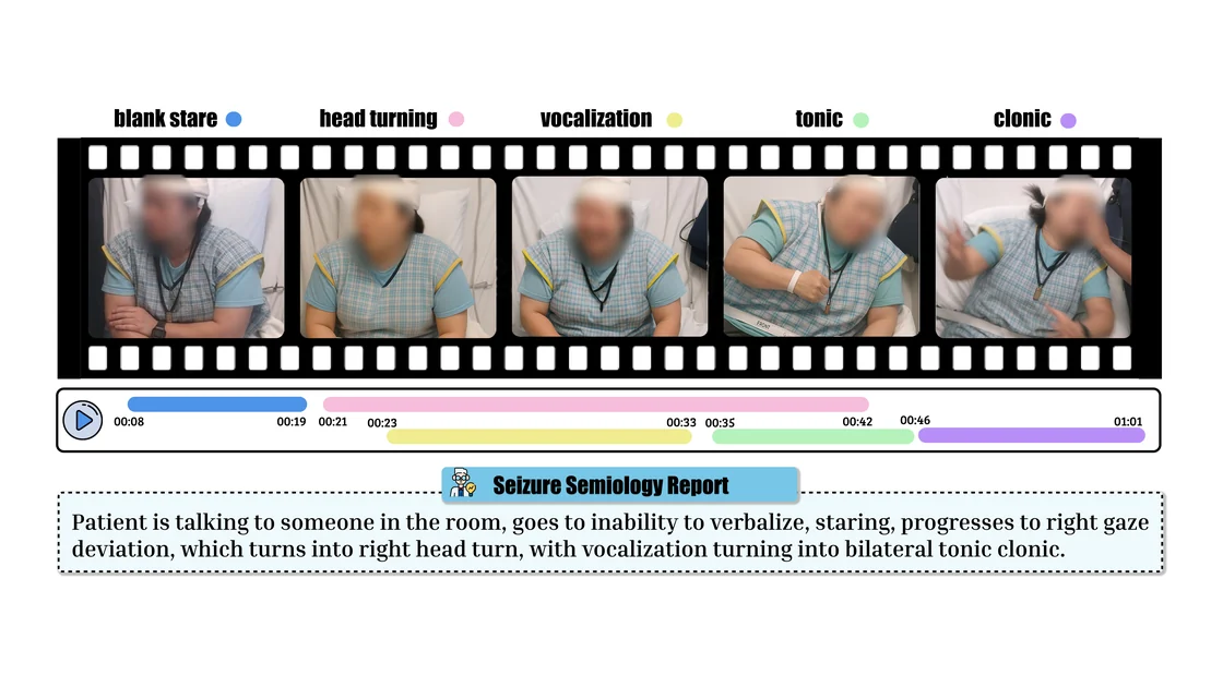 Part of Figure 1 of the S3 paper: five seizure video frames of an AI-generated patient, faces blurred, labelled blank stare, head turning, vocalization, tonic and clonic, above a colour-coded timeline and a short semiology report.